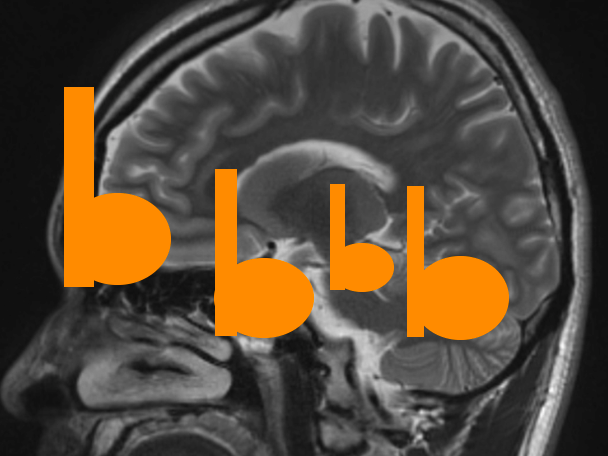 Brain – bit by bit