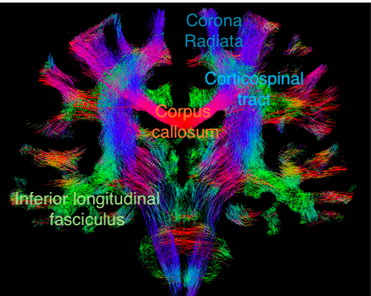White matter – Brain – bit by bit